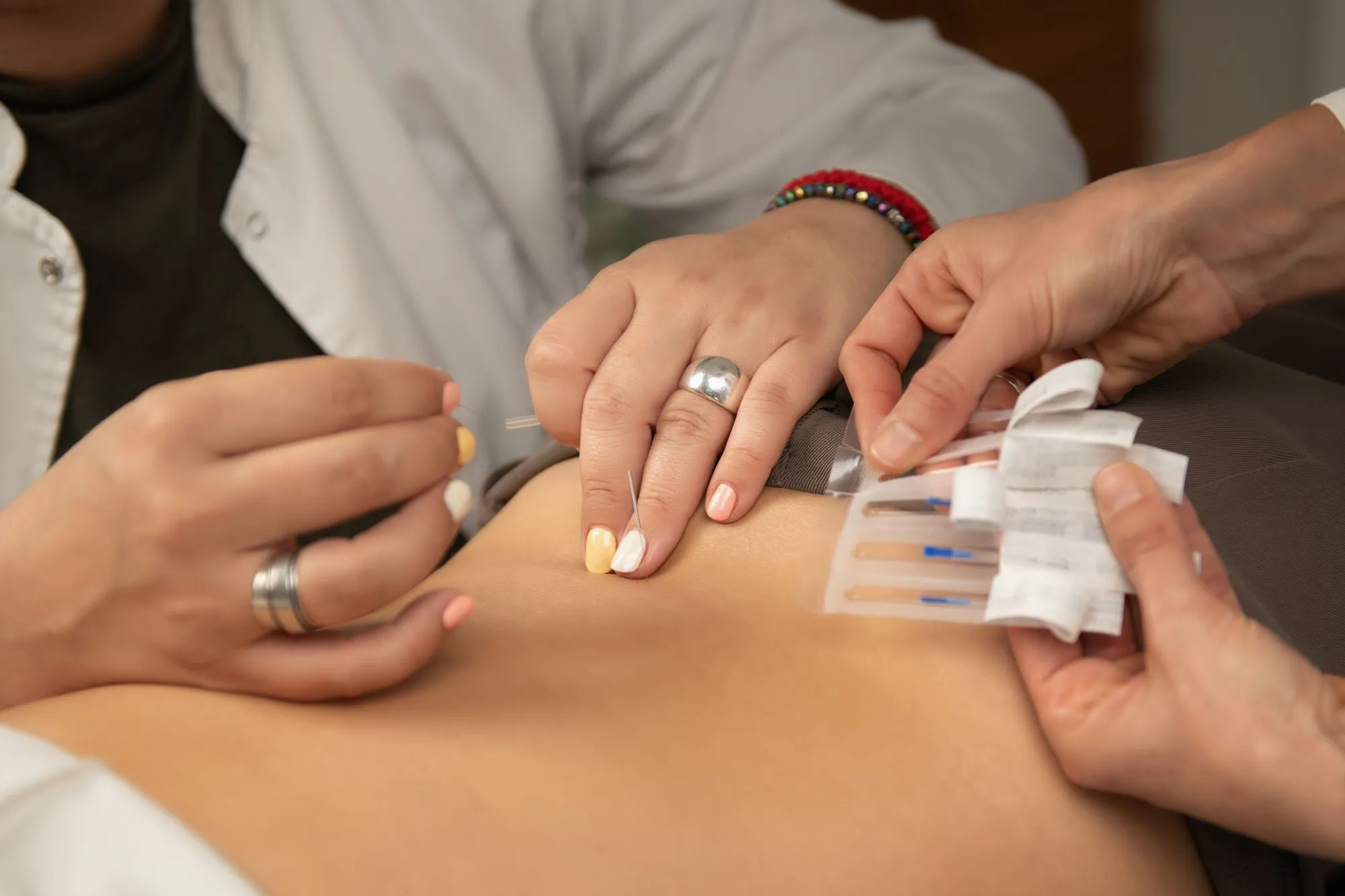 comparison of massage acupuncture and osteopathy for sciatica relief based on symptoms in Edmonton