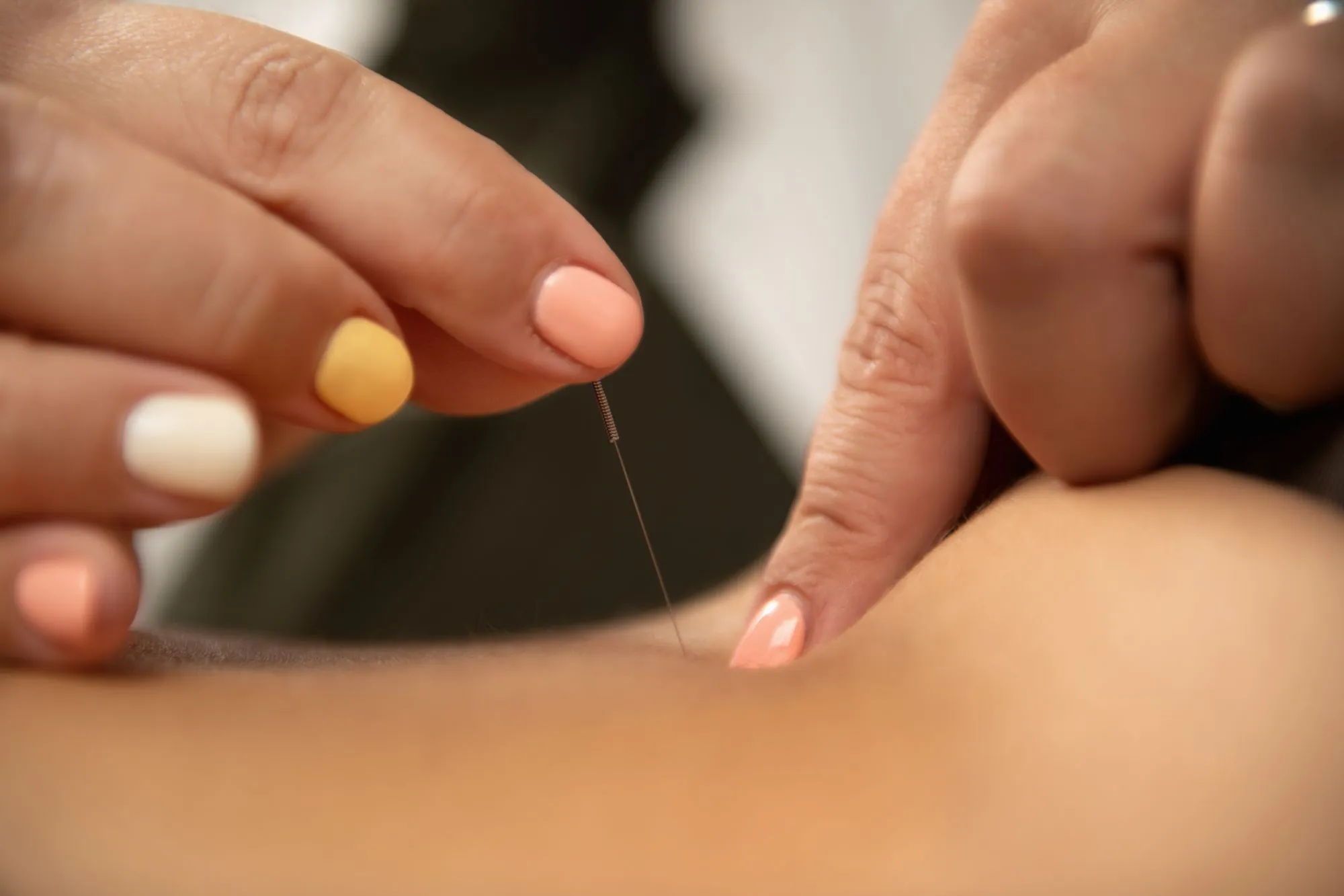 Massage therapy and acupuncture treatment options for chronic pain